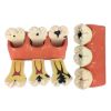 Picture of Caries Probe AIZ Original