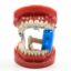 Picture of Dental Photo Contrast Black Background Set