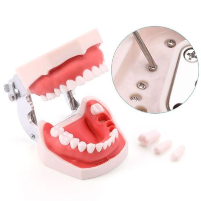 Picture of Orthodontic Teeth Model