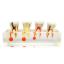 Picture of Root Canal Re-Treatment Files Dentsply Sirona Type Pattern