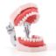 Picture of Tongue Depressor