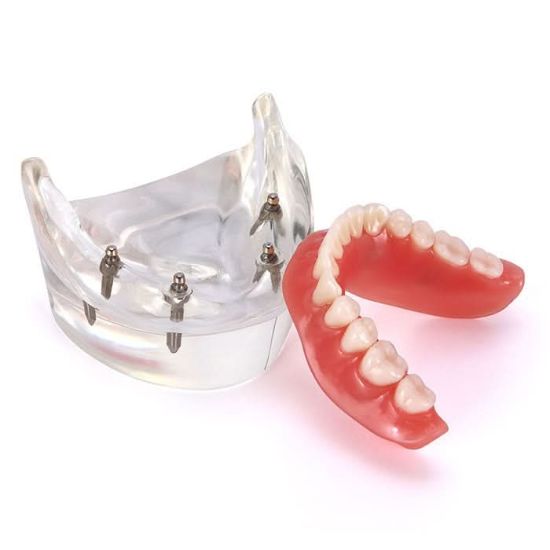 Picture of Tooth Jewellery